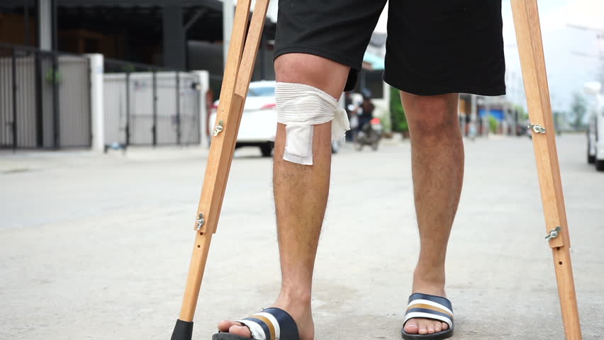 Man with small bandage on knee after surgery try to walk with wooden crutches.Video taking with 50p.
