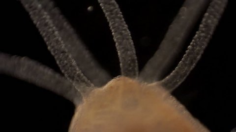 Microscopic footage of Hydra