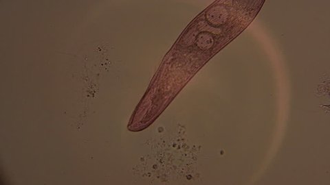 A microscopic view of the single-celled organism, Blepharisma.