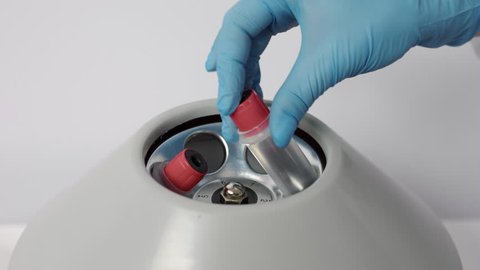 Close-up shot of Nurse puts blood sample in centrifuge | PRP footage 3 of 6