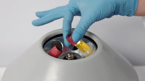 Close-up shot of nurse's hand in blue glove takes a centrifuged blood plasma from the centrifuge