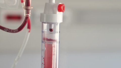 Close up footage of a bag of blood at the blood transfusion department, the shot is moving...
