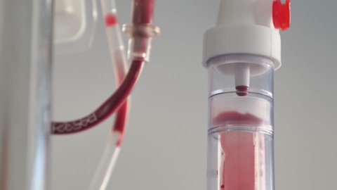 Close up footage of a bag of blood at the blood transfusion department, the shot is moving from the bottom to the top