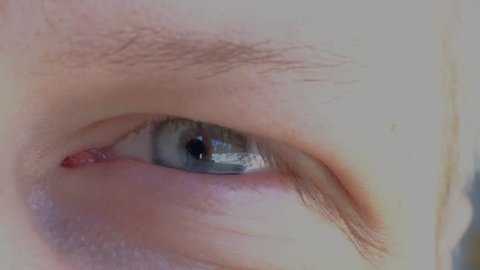 Stitched Wound Back Two Sutures After Stock Footage Video 100 Royalty Free Shutterstock