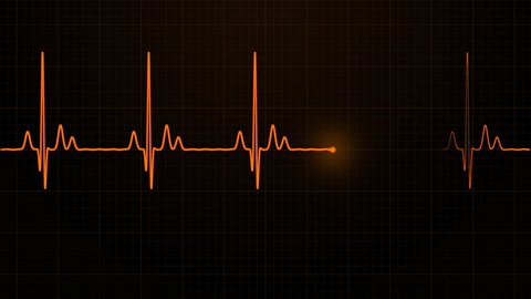Loopable: Orange EKG/ECG cardiogram oscilloscope monitor heartbeat line chart shows 60 BPM heart rate on black background with grid.