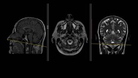 Brain MRI Scan (Magnetic Resonance) Ultra HD 4k Loop Record