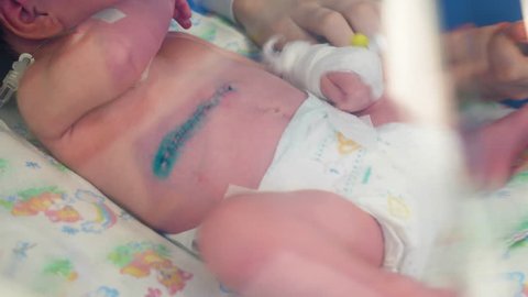 A toddler with disinfected stitches is lying in a medical box