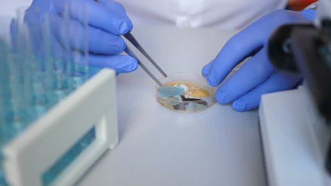Scientist analyse in bacteria culture. Closeup. Petri dish with Bacteria in chemical lab. Hand in blue glove holds petri dish with mold and bacterium colony. Science professional grafting bacteria.