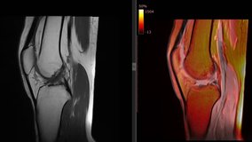Knee MRI (Magnetic Resonance Imaging) Loop Record