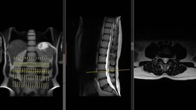 Lumbar MRI (Magnetic Resonance Imaging) Loop Record 4k-HD 