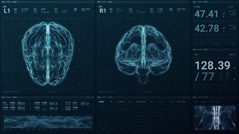 A high tech screen displays a brain in 3D and monitors its vital signs with statistical data for a neurology department