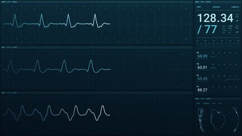 Futuristic and high tech heart rate and blood pressure monitoring screen displays data of a patient : vidéo de stock