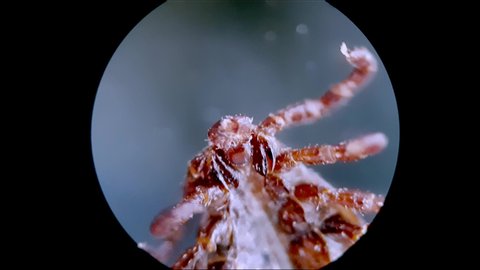 alive tick under microscope video in 4k. Tick can transmit serious disease like encephalitis, piroplasmosis, Lyme disease