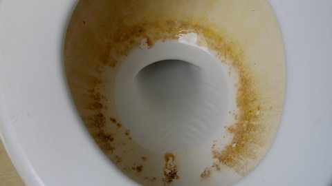 Dirty toilet bowl under lid.