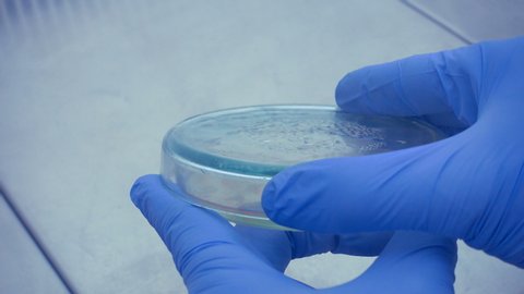 Open a petri dish to see bacteria. Close-up scientist in blue gloves opens a petri dish with colonies of bacteria.