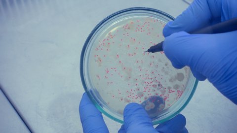 Mark with a marker of dangerous bacteria for humans. Close-up scientist in blue gloves marks the bacteria marker in a petri dish.