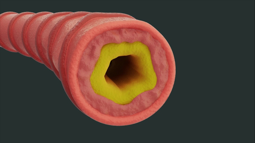 phlegm removal mucus chest throat respiratory: วิดีโอสต็อก (ปลอดค่า ...