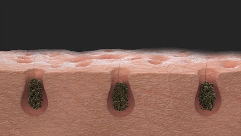 3D animation close-up skin dirt removal. Deep cleansing skin. Skin pores. Acne cleansing. skin pore cleaning 