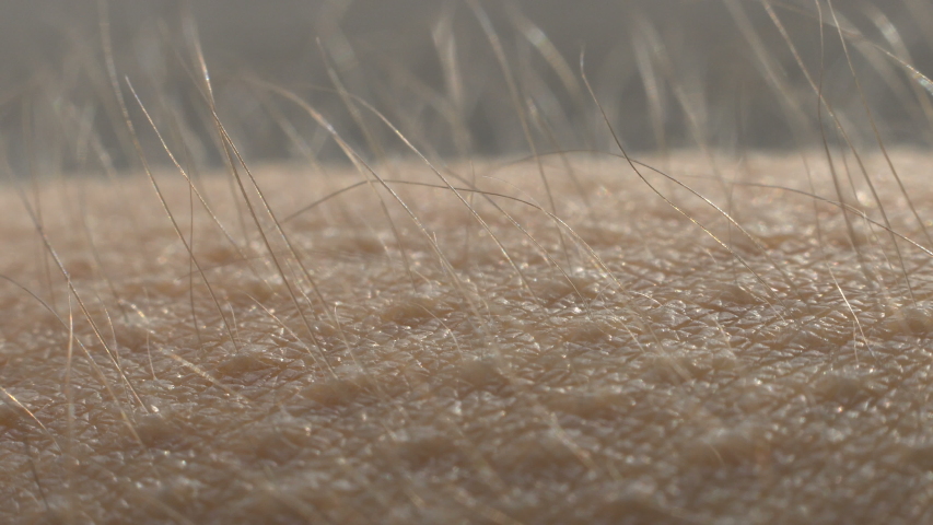 Goosebumps Close Up. Hair On 스톡 동영상 비디오(100% 로열티 프리) 1031071640 | Shutterstock