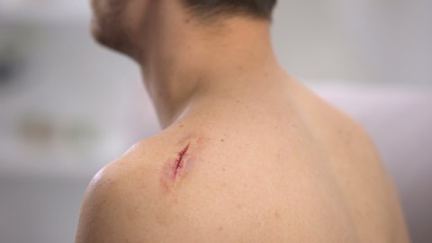Doctor hands applying adhesive bandage on scratched shoulder of male patient