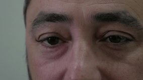 Close-up of a patient getting an eye exam with the phoropter to test for prescription - Powered by Shutterstock - Get 15% off with code: PIKWIZARD15