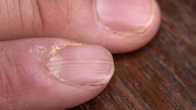 This macro video shows the hands of a person clipping and trimming their old crusty nails with nail clippers, very close up.