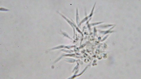 Trypanosoma cruzi microscope view; human diseases