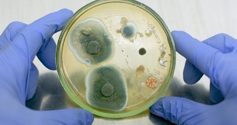Analysis of the results of an experiment with bacteria for antibiotic resistance. A scientist examines a Petri dish by rotating it in a circle. Mold inhibits the growth of bacteria.