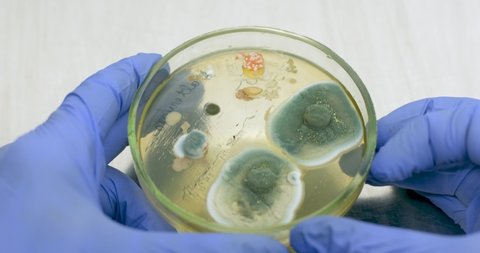 Close-up scientist with gloved hands opens a petri dish and examines it in search of bacteria. Analysis of the results of an experiment with bacteria for antibiotic resistance.