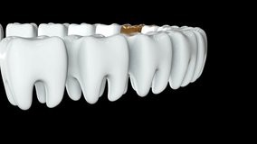 Golden tooth in a row of the white teeth. 3D render. Dental, out of crowd, business concept. Video available in FullHD and HD render footage