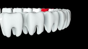 Red tooth in a row of the white teeth. 3D render. Dental, out of crowd, business concept. Video available in FullHD and HD render footage