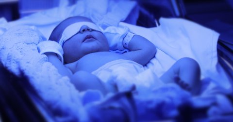 Newborn Baby Boy Under Phototherapy Stock Footage Video 100 Royalty Free 1032848078 Shutterstock