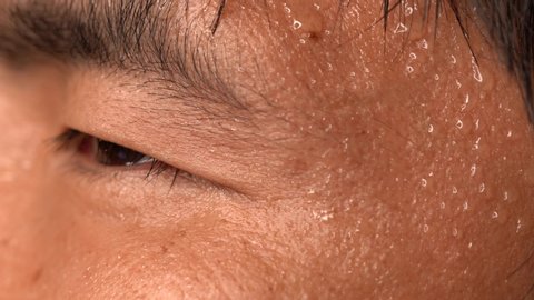 This close up macro video shows a nervous asian man's sweating skin.