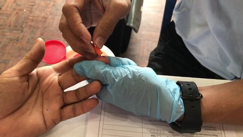 Muadzam Shah,  Malaysia - July 3rd, 2019 : A doctor  doing a finger prick test for blood group and rh factor testing by agglutination method