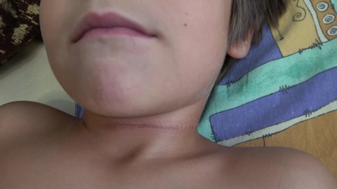4K Child touches sore mark on his neck
