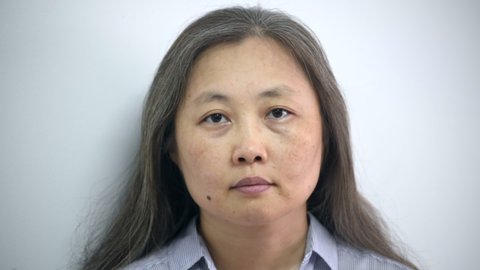 an asian middle aged woman lifts face skin and gets depressed of her look