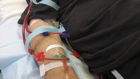 Close-up of a patient's arm as they have medical dialysis treatment at the hospital