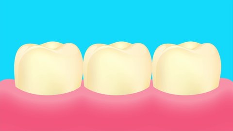 yellow to white teeth. teeth whitening, dental care concept. Veneers on human teeth.  Before and After. Deep cleaning, clearing tooth process.