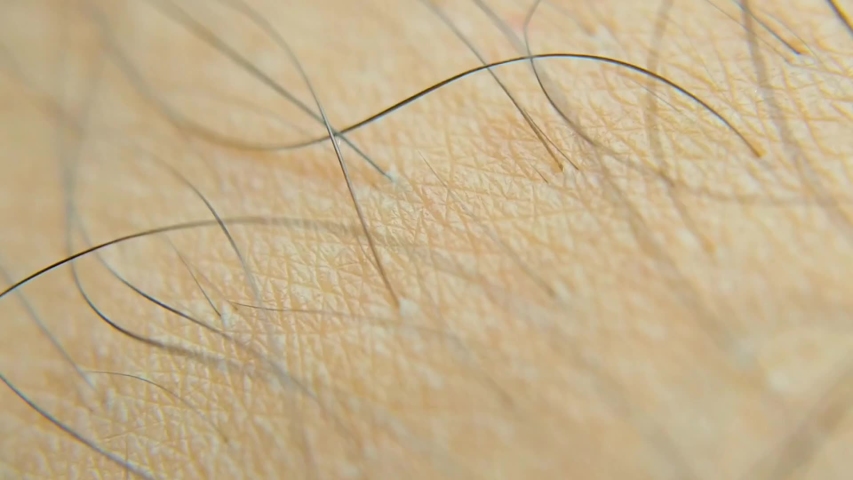Extremely Close up of strands of hair rooted in skin showing Detailed textures of skin pattern. Selective focus of slowly moving shot. Hair healthcare concept. Royalty-Free Stock Footage #1034166863