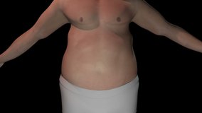 This video shows the Gastric Banding treatment for weight loss