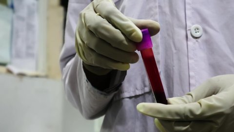 upside down tilting and inverting of blood sample tube to mix blood with anticoagulant to prevent clotting in gloved hand