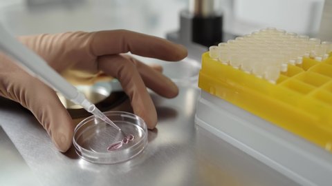 Technician in brown latex gloves is spreading drops of material inside the Petri dish during the in vitro fertilization process in the IVF lab. Closeup video recording with selective focus.