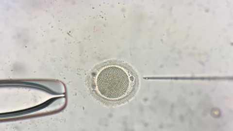 Wonderful macro view through the microscope at process of the in vitro fertilization of a female egg inside IVF dish in the laboratory. Video recording.