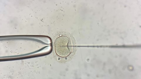 Amazing macro view through the microscope at process of the in vitro fertilization of a female egg inside IVF dish in the laboratory. Video recording.