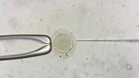 Astonishing macro view through the microscope at process of the in vitro fertilization of a female egg inside IVF dish in the laboratory. Video recording.