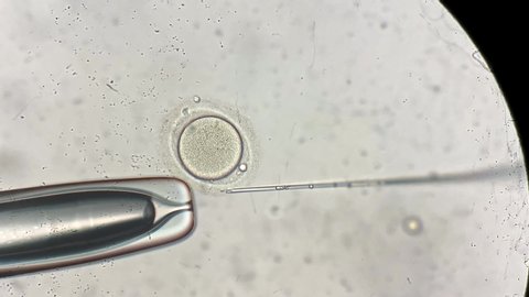 Extraordinary macro view through the microscope at process of the in vitro fertilization of a female egg inside IVF dish in the laboratory. Video recording.