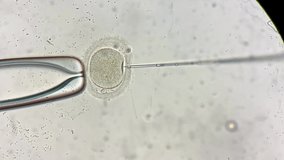 Remarkable macro view through the microscope at process of the in vitro fertilization of a female egg inside IVF dish in the laboratory. Video recording.