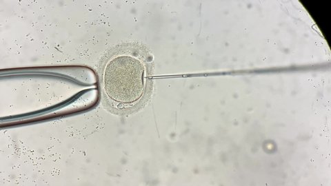 Remarkable macro view through the microscope at process of the in vitro fertilization of a female egg inside IVF dish in the laboratory. Video recording.