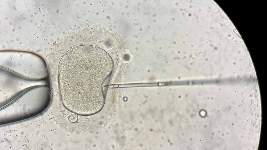 Closeup view through the microscope at process of the in vitro fertilization of a female egg inside IVF dish in the laboratory. Video recording. | Shutterstock HD Video #1035267101