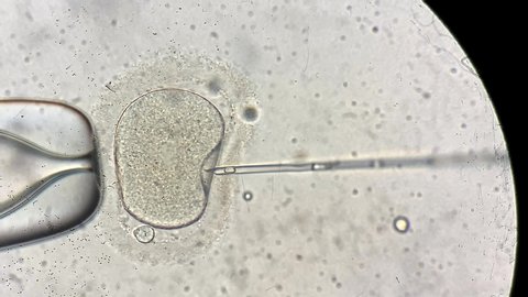 Closeup view through the microscope at process of the in vitro fertilization of a female egg inside IVF dish in the laboratory. Video recording.
